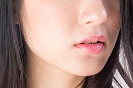 エレクトロポレーション（電気穿孔法）とは？